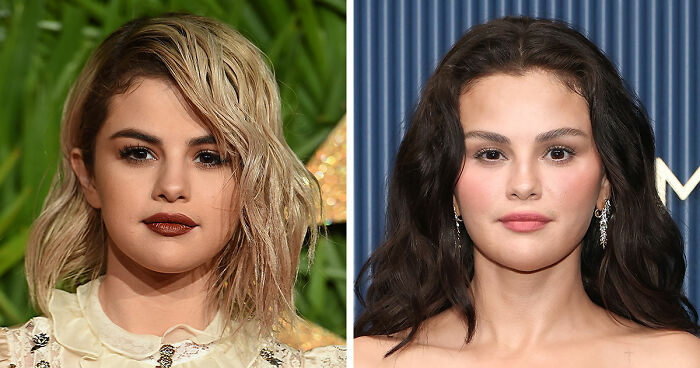 The 15 Biggest Transformations As Plastic Surgery And Weight Loss Dominate The 2026 Emmys