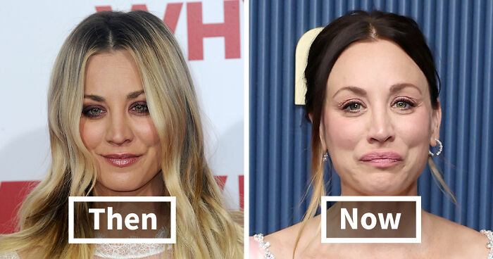 The 15 Biggest Transformations As Plastic Surgery And Weight Loss Dominate The 2026 Emmys