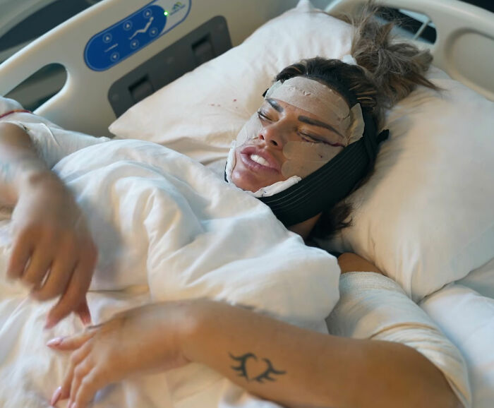 Katie Price recovering in a hospital bed with bandages on her face after corrective surgery. Katie Price recovering in a hospital bed with bandages on her face after corrective surgery.