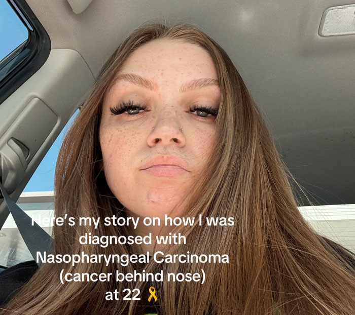 A woman diagnosed with rare cancer, previously thought to be altitude sickness, after her ears wouldn't pop post-flight. A woman diagnosed with rare cancer, previously thought to be altitude sickness, after her ears wouldn't pop post-flight.