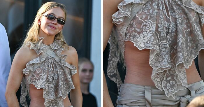 Sydney Sweeney’s Latest Photos Have Netizens Zooming In On Mysterious Marks On Her Rib And Stomach