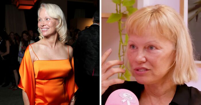“Around 10 Years To Live”: Pamela Anderson Reveals Details Of Her Harrowing Health Battle