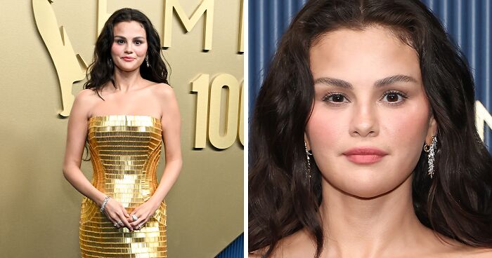 Doctor Weighs In After Selena Gomez’s “Unrecognizable” Emmys Appearance Had Fans Begging Her To Lay Off The Botox