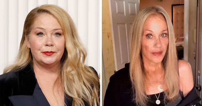 Christina Applegate Sparks Fresh Concern After Appearing In First Photos Since Four-Month Hospital Stay