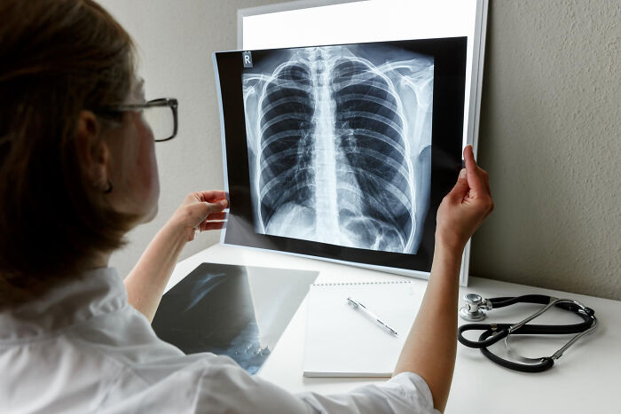 A doctor examines a chest X-ray on a light board, suggesting unsettling and creepy things hidden from view.