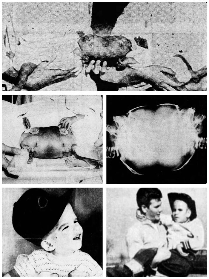 Vintage medical photos documenting a rare case in medical history