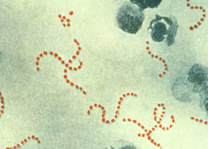 The Doctor Who Proved That Handwashing Saves Lives And How It Destroyed His Career