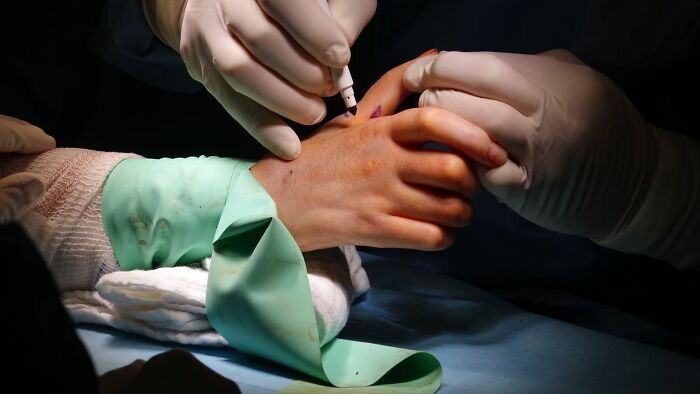Medical professionals mark a patient's hand for surgery, illustrating a scenario with patients and medical care.