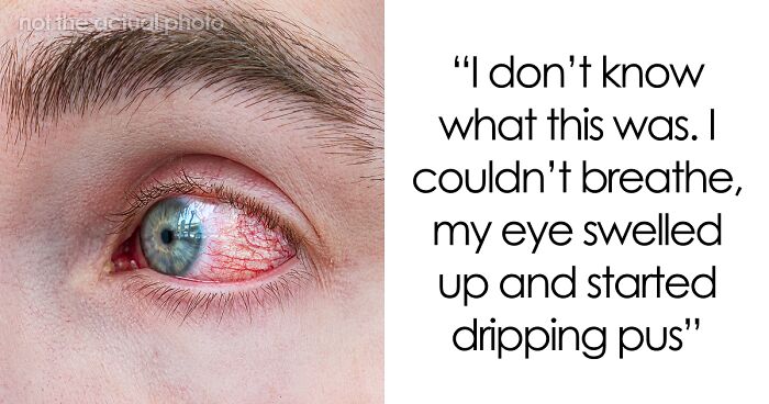 86 Times People Experienced Extreme Illness And Sickness And Lived To Tell The Tale