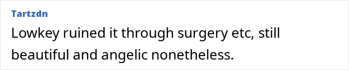 A social media comment discussing a supermodel's viral transformation and potential cosmetic surgery