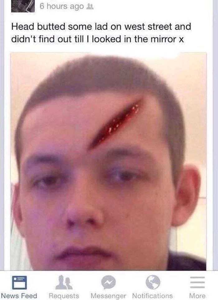 A man with a large, bloody gash above his eyebrow, indicating a cringy fail. This is not AI Girlfriend material.