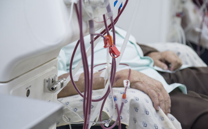 Medical equipment with tubes connected to a patient's arm, illustrating extreme illness treatment.