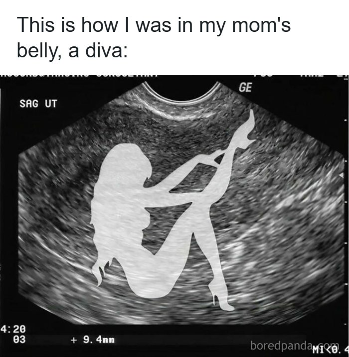A funny ultrasound image of a diva silhouette representing funny memes about being a woman