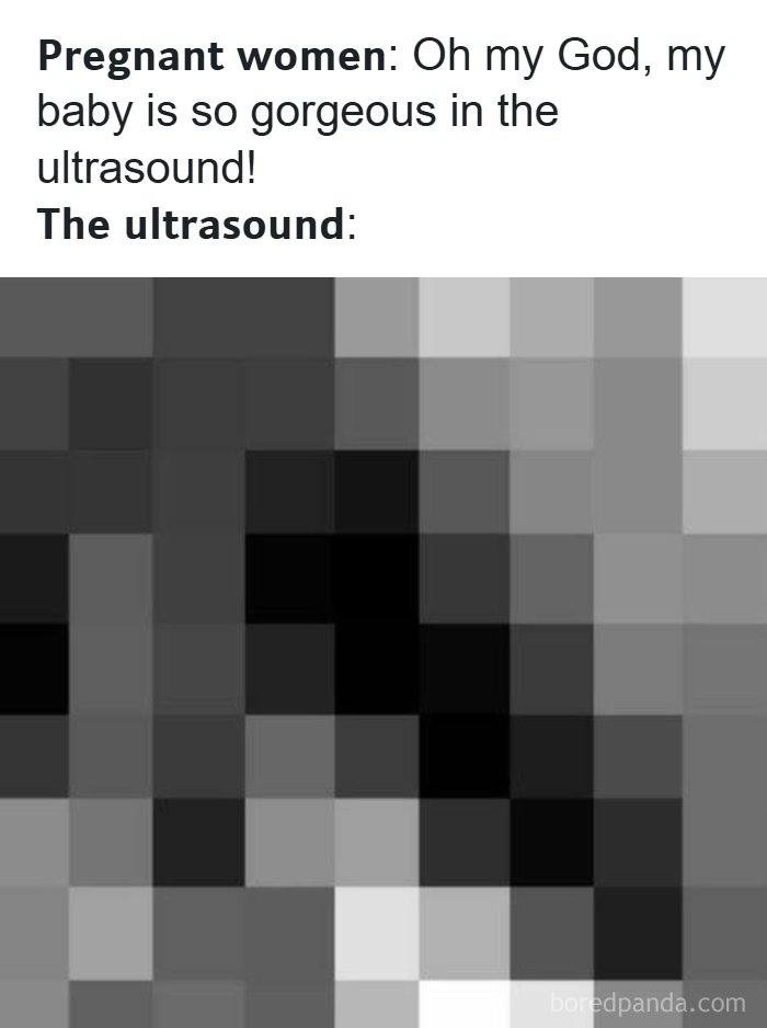 A meme contrasting expectations with reality, showing a pixelated ultrasound, part of a collection of hilarious memes.