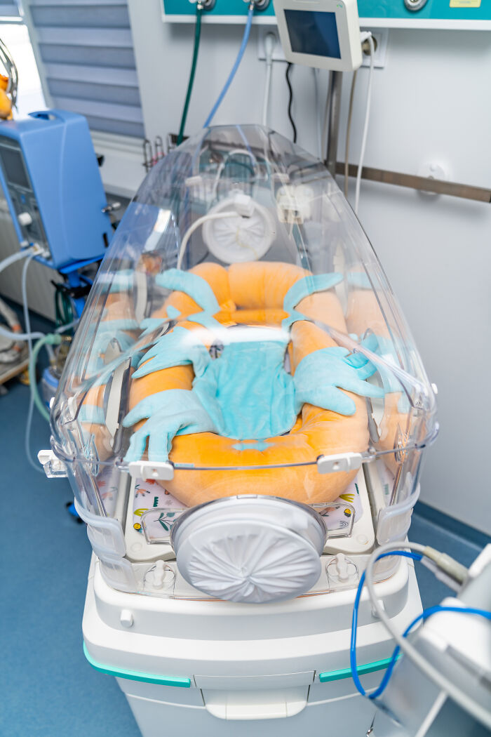 A baby lies in an incubator in a hospital, showcasing various pain reactions from infants.