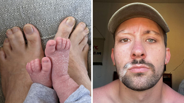 75 People With Physical Features So Rare They Almost Don’t Look Real
