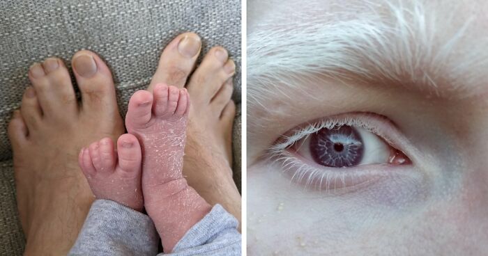 75 People Who Clearly Won The Genetic Lottery In The Most Unexpected Ways