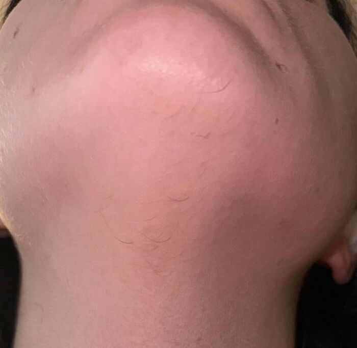 Close-up of a chin showing chin hair, which is one of the unexpected body changes in 30s and 40s