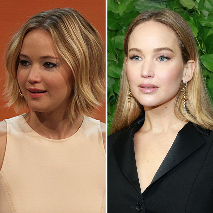 Side-by-side comparison of Jennifer Lawrence pre- and post- plastic surgery confession, sparking fresh scrutiny.