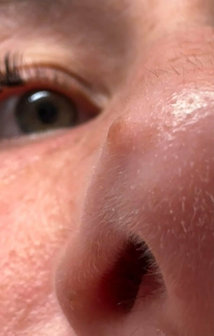 Close-up of a woman's nose, highlighting unexpected facial skin and body changes in her 30s and 40s.
