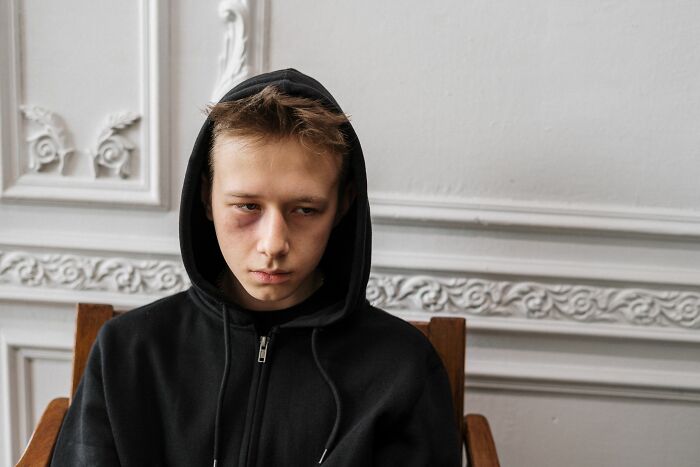 A young person with a black eye, wearing a black hoodie, symbolizing the impact of encountering a sociopath.