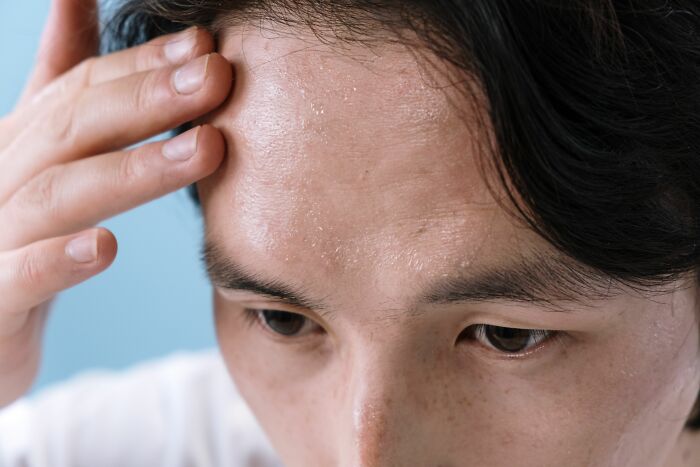 A person wiping sweat from their forehead, a health symptom that can be a cause for concern to doctors.