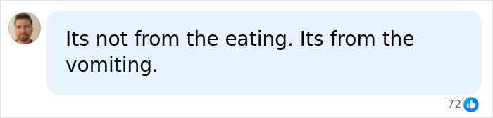 A social media comment clarifies that health issues stem from vomiting, not eating, related to extreme eating.