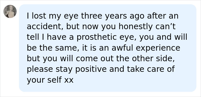 A supportive comment sharing an experience of using a prosthetic eye due to vision loss and tumor