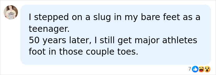 19YO Accepts Friends’ Slug-Eating Dare, Then A Hidden Parasite Causes A Devastating Brain Illness 19YO Accepts Friends’ Slug-Eating Dare, Then A Hidden Parasite Causes A Devastating Brain Illness