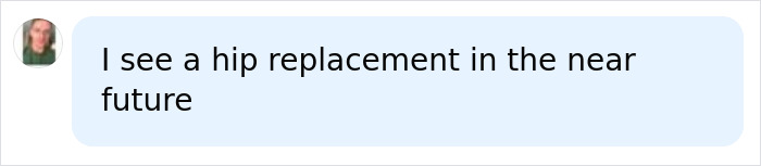 Prediction of a hip replacement related to Madonna Prediction of a hip replacement related to Madonna