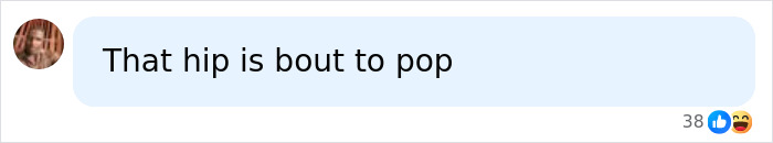 Social media comment expressing concern over Madonna's hip during VMAs performance Social media comment expressing concern over Madonna's hip during VMAs performance