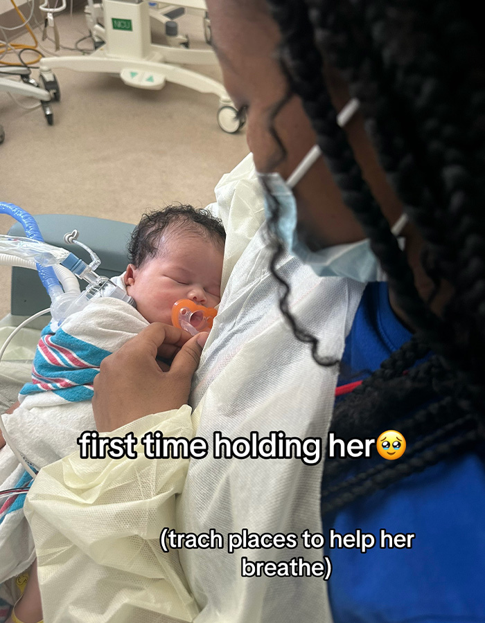 A mother holding her newborn baby for the first time after a routine scan led to a medical procedure. A mother holding her newborn baby for the first time after a routine scan led to a medical procedure.
