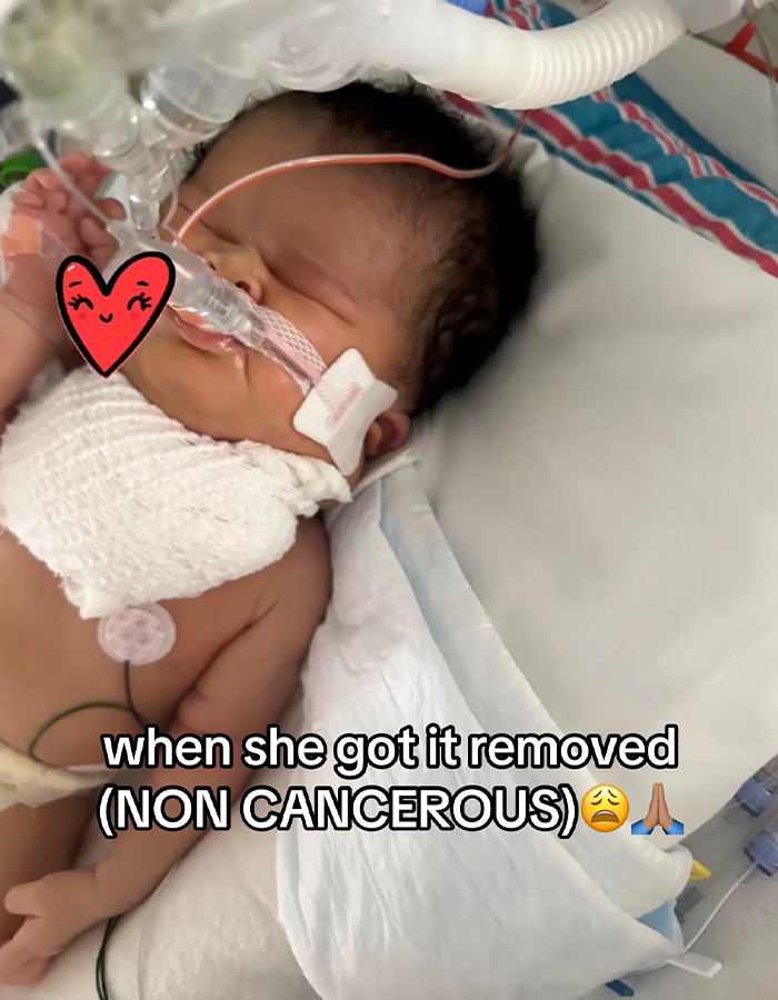 An infant in the hospital following a routine scan and successful non-cancerous mass removal. An infant in the hospital following a routine scan and successful non-cancerous mass removal.