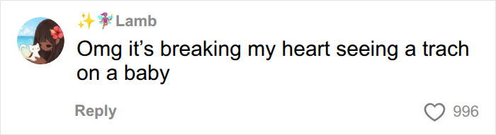 A social media comment expressing sadness about a baby requiring a trach after a routine scan. A social media comment expressing sadness about a baby requiring a trach after a routine scan.