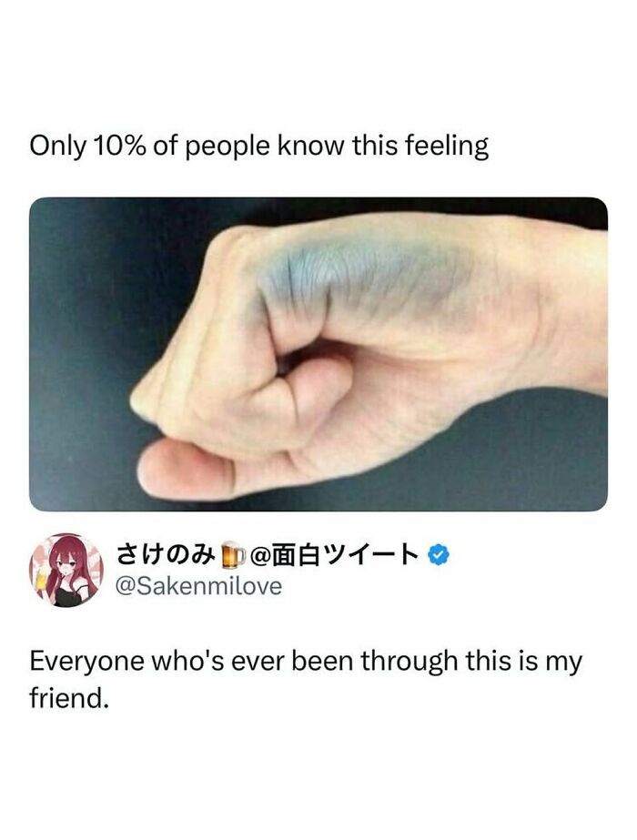 Hand with blue bruised knuckle showing a funny feeling meme