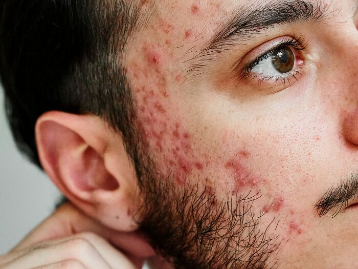 57 People Caught Their Partners In These Gross Acts And Could Never Look At Them The Same