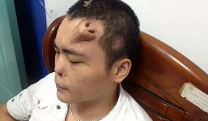 Person with facial physical deformities resting showing rare physical features