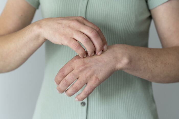 A person scratches their hand, showing a skin irritation, one of the innocent health symptoms that terrify doctors.
