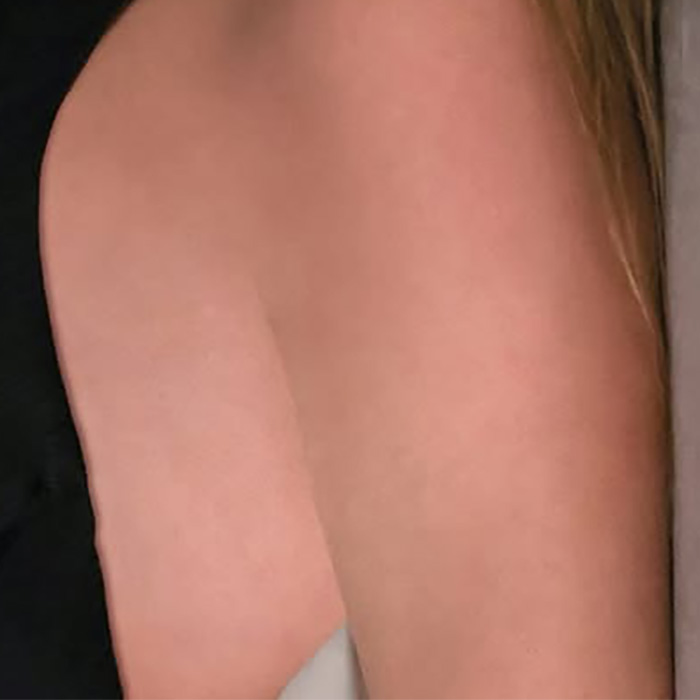A close-up of Taylor Swift's arm showing a bizarre editing detail that sparked discussion online A close-up of Taylor Swift's arm showing a bizarre editing detail that sparked discussion online