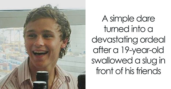 19YO Challenged To Eat A Slug Ends Up Facing A Medical Nightmare Beyond Anyone’s Imagination
