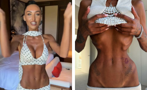 Influencer Gives Details On Bone-Breaking Plastic Surgery As Doctor Issues Urgent Warning