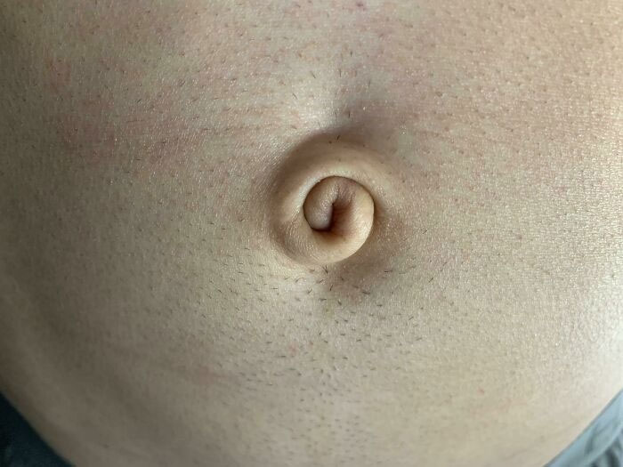 A close-up of a navel showing a rare and unexpected body quirk: a spiral-shaped belly button.