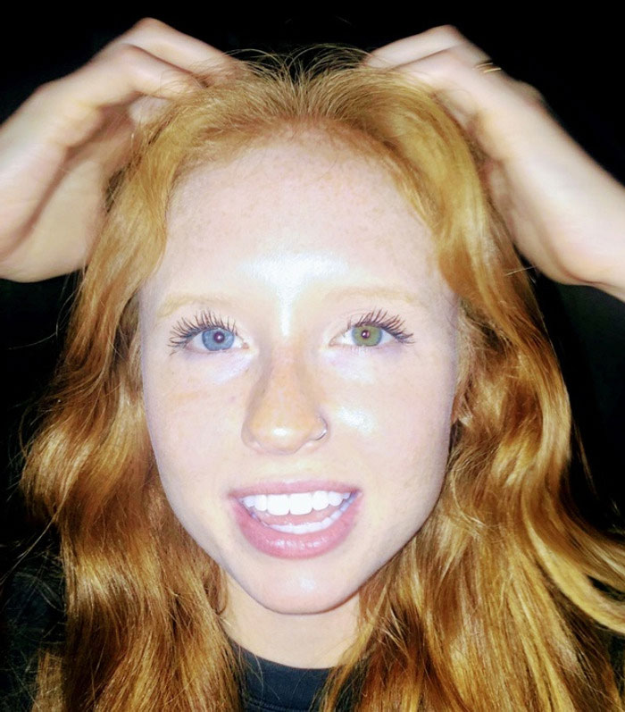 A red-haired woman with striking heterochromia, one blue eye and one green eye, a fascinating body quirk.