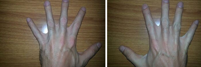 Two hands displayed side-by-side on a wooden surface, showing unusual body quirks.