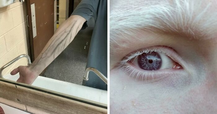 “40 Years Of Hiding These”: 85 Surprising Body Features That Make People Stand Out