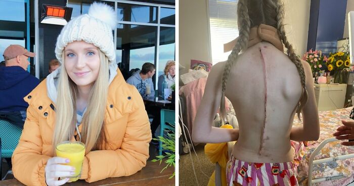 Woman Chooses Euthanasia At 26, Saying Living With Her Condition Frightens Her More