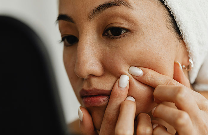 Close-up of woman checking skin for clusters of white spots on her face