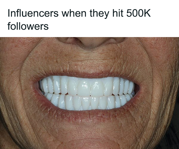 Meme featuring bright white veneers symbolizing influencers getting 500k followers.