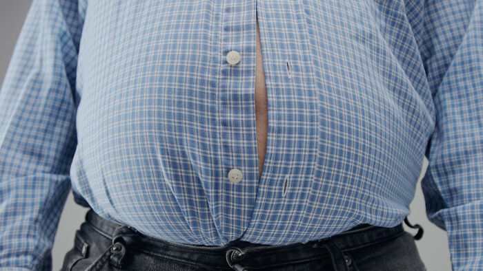 Close up of a man in a tight button down shirt illustrating weight advice from doctors and nurses.