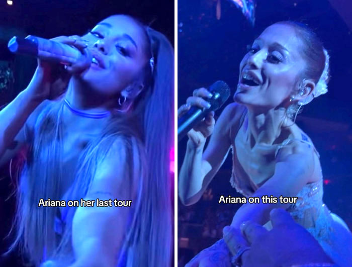 After Ariana Grande&rsquo;s Face Sparks Claims Her Body Is &ldquo;Starting To Eat Muscle,&rdquo; Experts Weigh In